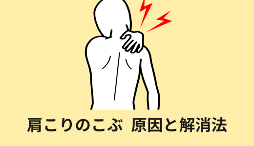 肩こりこぶの原因は筋肉の緊張？症状のメカニズムを解説