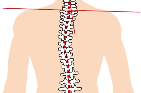 背骨が曲がっている？整体で姿勢を改善して健康を取り戻す方法と注意点を徹底解説