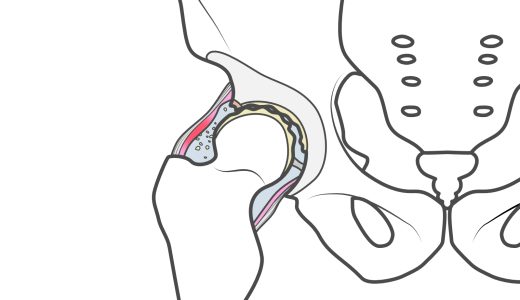 股関節痛に悩む方へ 何科を受診すべきか迷ったときの病院選びチェックリスト